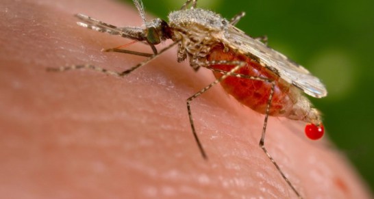 brazil-zika-outbreat-brain-damange